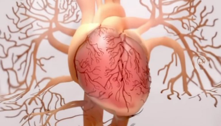 Pericardite, il professor Massimo Piepoli spiega qual è il primo sintomo più comune per riconoscerla