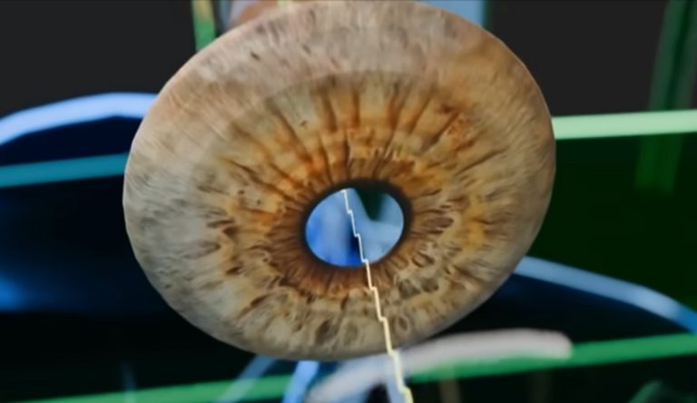 Sperimentato con successo un trattamento basato su iniezione di cellule staminali che migliora la vista