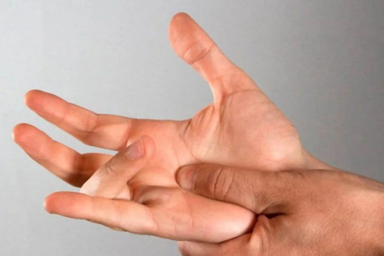 Dito a scatto, il Dottor Mattia Carozzo spiega cos’è, quali sono le possibili cause e come si diagnostica