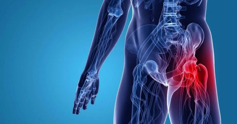 Dolore all’anca, quali sono i sintomi da non ignorare se compaiono sotto i 40 anni