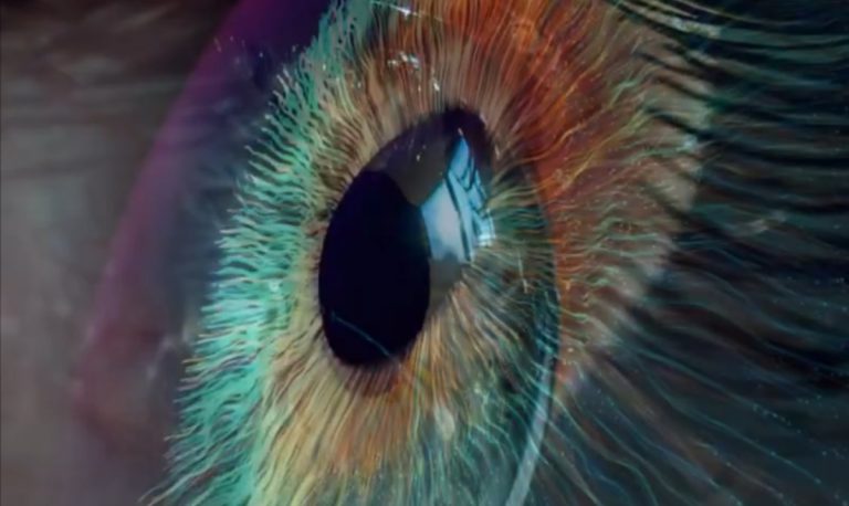 Cheropigmentazione, l’intervento che modifica il colore degli occhi: ecco chi può farlo e quali sono i rischi