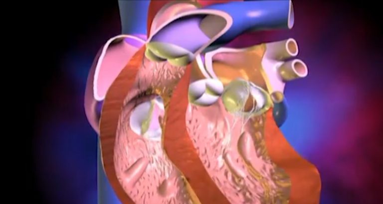 Stenosi aortica, il dottor Giuseppe Coletti spiega quali sono i sintomi e come si diagnostica