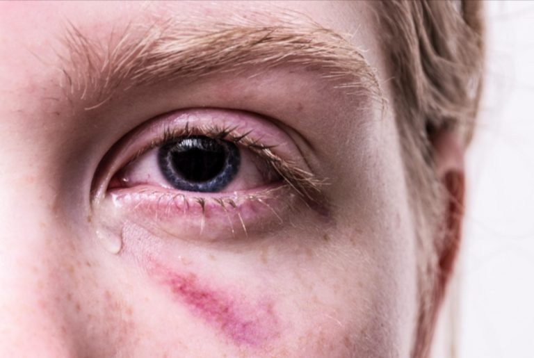 Piangere fa davvero bene all’umore? Ecco i risultati sorprendendi di una ricerca