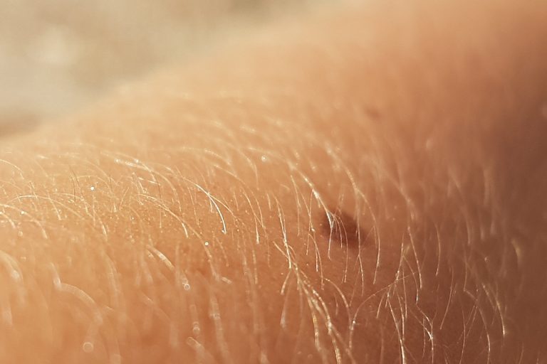 Nei sospetti, è più rischioso toglierli o non toglierli?